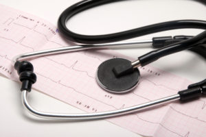 A ekg strip from a health clinic and stethoscope